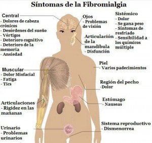 sintomas-fibromalgia